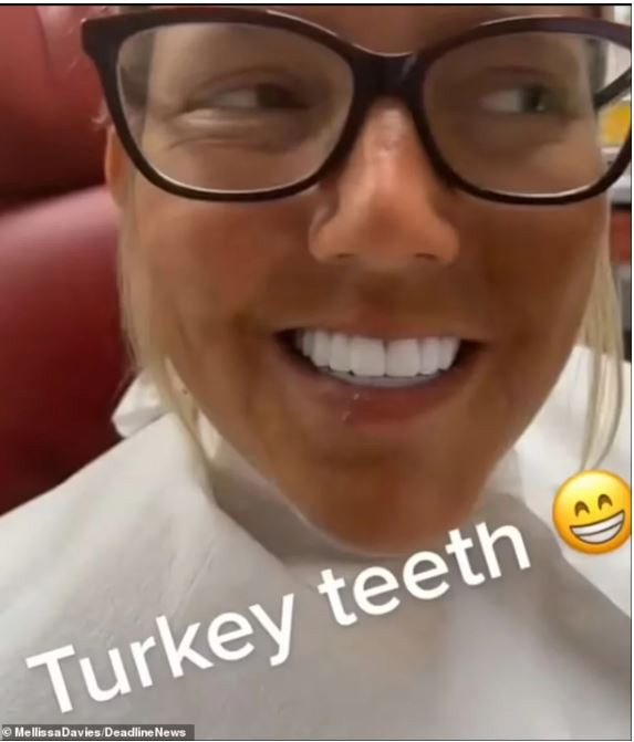 δοντια της τουρκιας