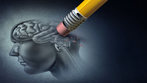 alzheimer-1.jpg