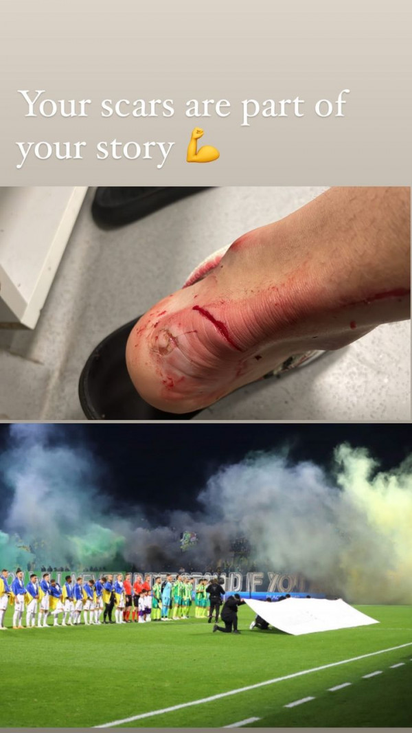 λοπεςποδι
