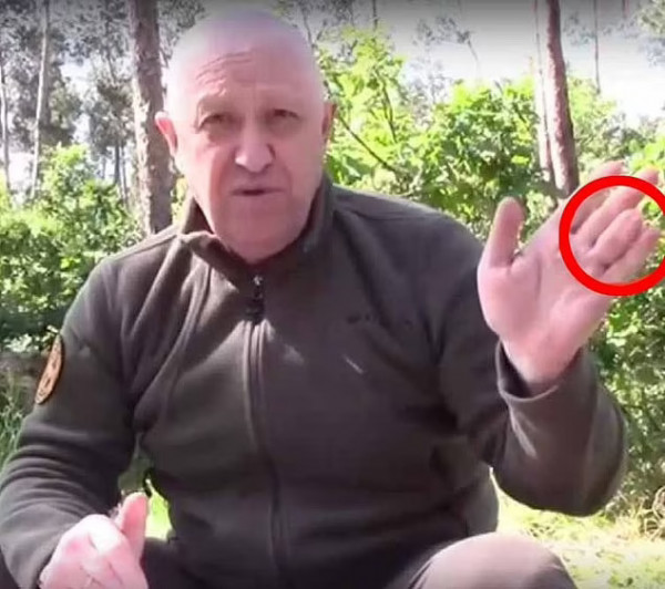 πριγκοζιν δαχτυλο