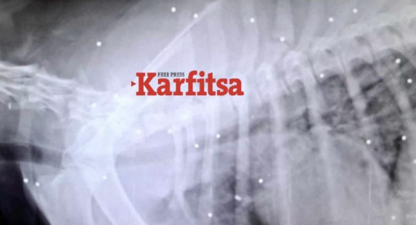 υκγ