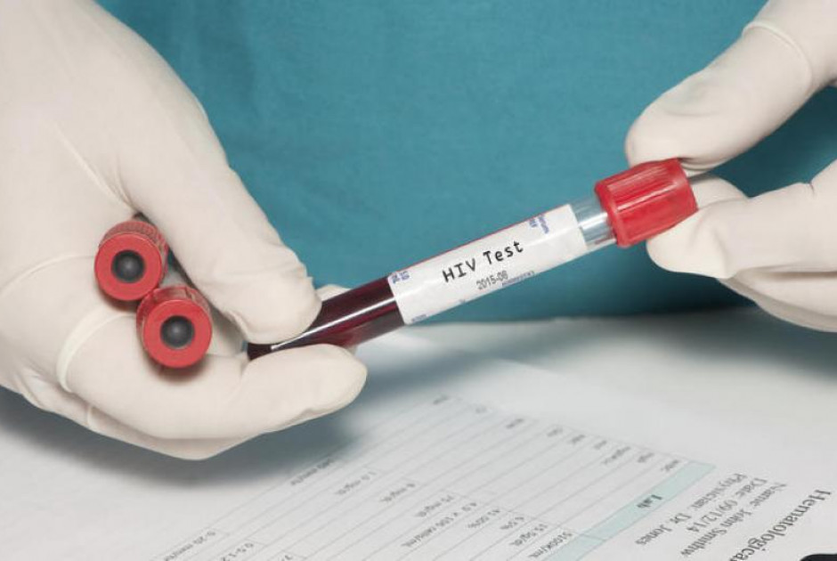 &Pi;ό&sigma;&alpha; ά&tau;&omicron;&mu;&alpha; &zeta;&omicron;&upsilon;&nu; &mu;&epsilon; HIV &sigma;&tau;&eta;&nu; &Kappa;ύ&pi;&rho;&omicron;