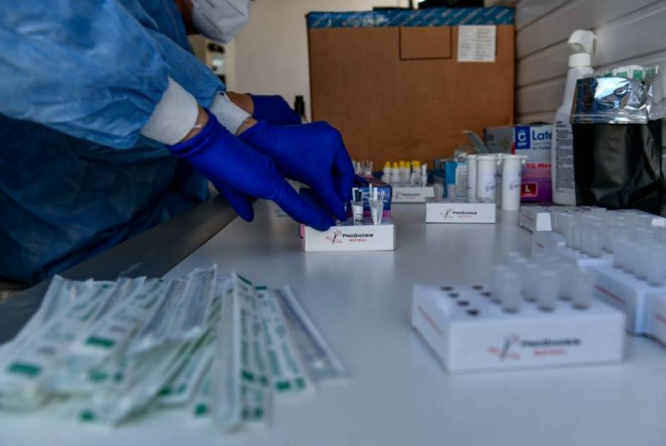 Έρευνα: Η λοίμωξη με Covid γερνάει τα αιμοφόρα αγγεία