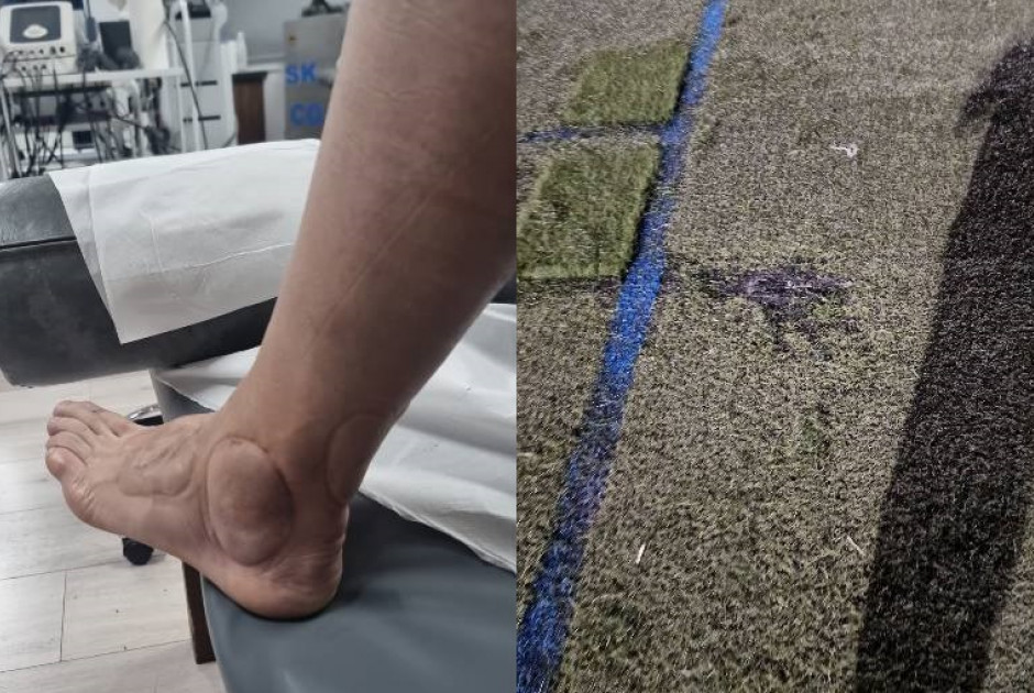 Ομάδα στην Κύπρο έβαλε ΛΟΥΚΕΤΟ: Άθλιες συνθήκες, σοβαροί τραυματισμοί και καταστροφή του αγωνιστικού
