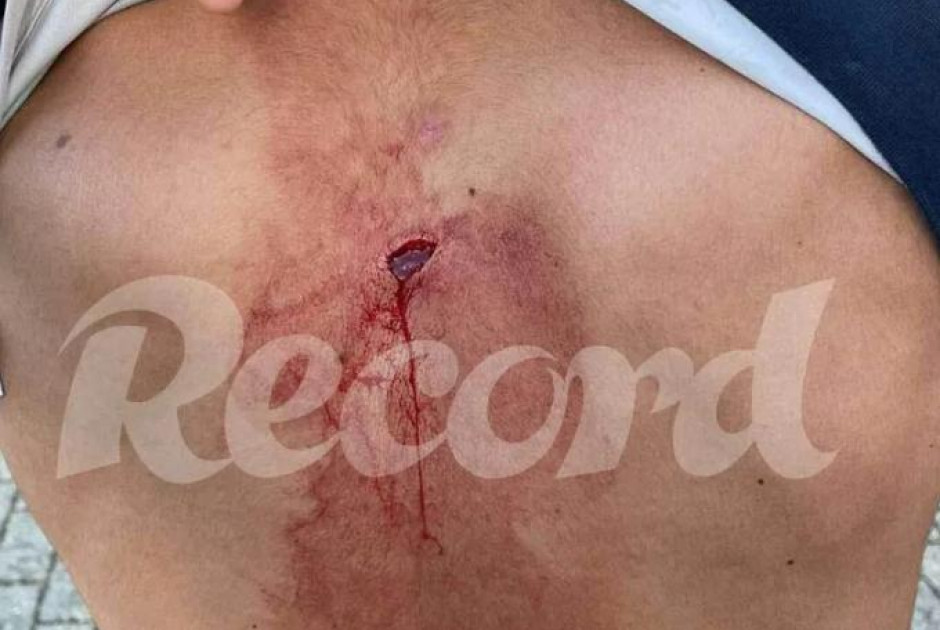 Αγριεύουν τα πράγματα πριν το Μπενφίκα-Σπόρτινγκ: Μαχαιρώθηκε οπαδός!