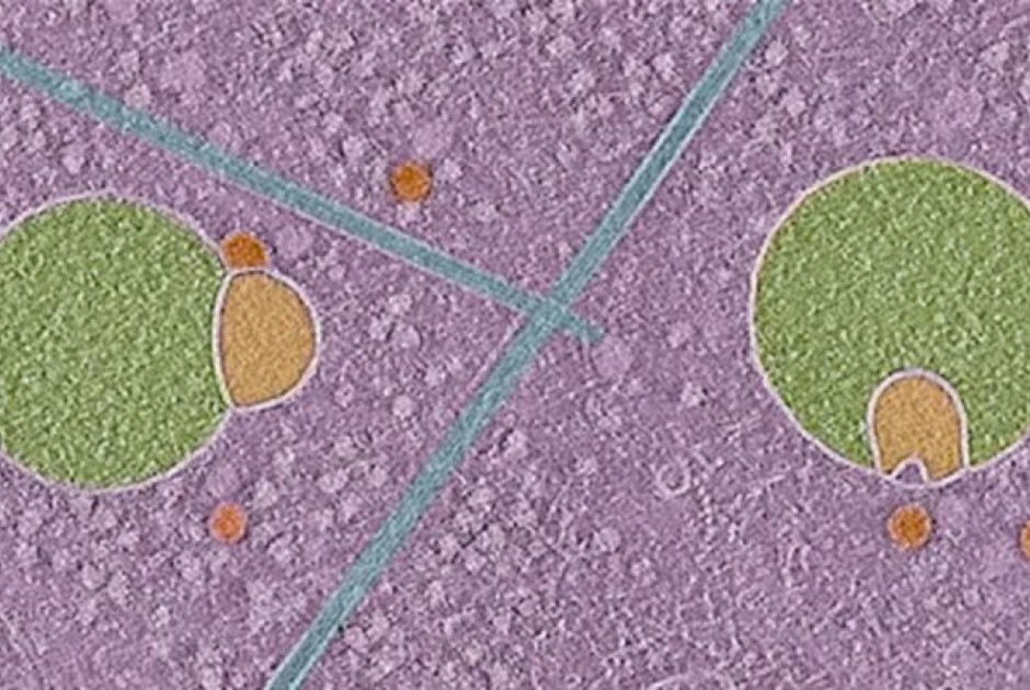 Hemifusome: Ανακαλύφθηκε ένα άγνωστο μέχρι σήμερα μέρος των ανθρώπινων κυττάρων