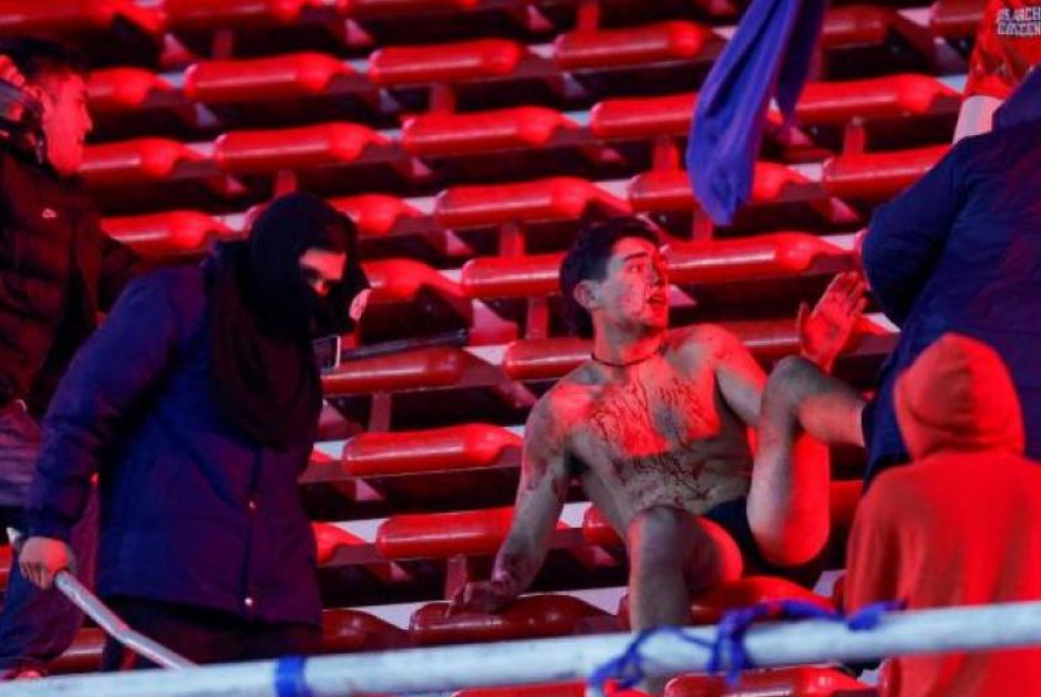 Χάος στο Copa Sudamericana: Φοβερά επεισόδια και δεκάδες τραυματίες (Βίντεο)