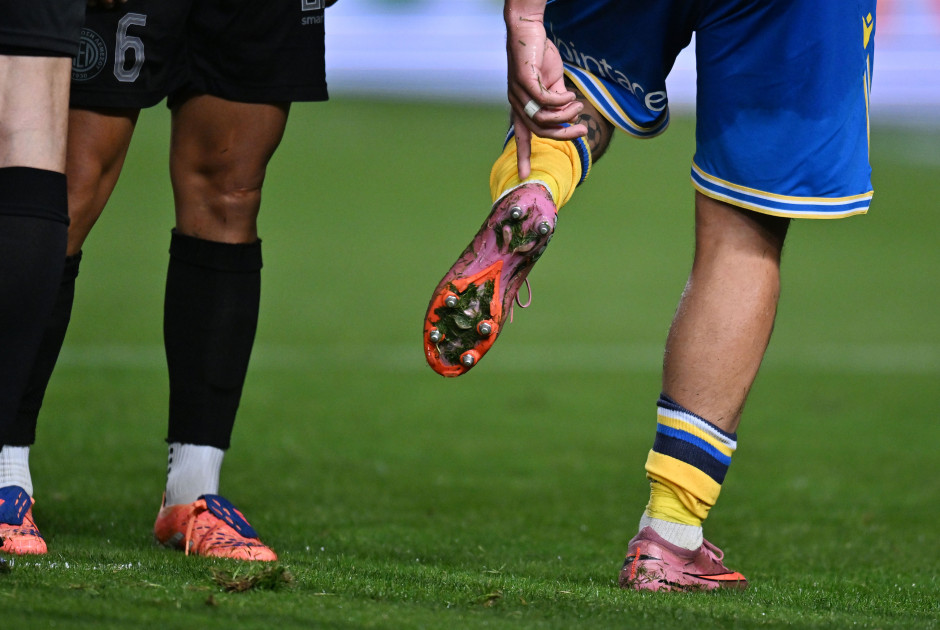 Χάνει Πιέρο το ΑΠΟΕΛ- Το διάστημα που θα απουσιάσει!