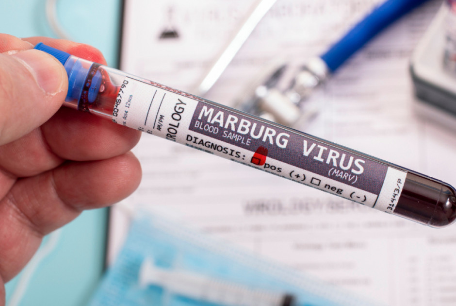 Κρούσματα του θανατηφόρου ιού Marburg ανακοίνωσε η Αιθιοπία