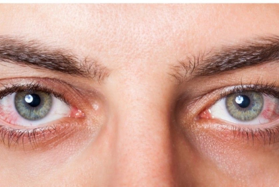 Έρευνα: Τα μάτια προειδοποιούν για την άνοια 12 χρόνια πριν από τη διάγνωση