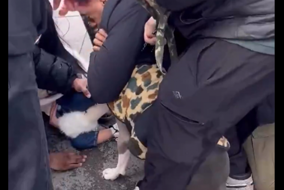 Εφιαλτικές στιγμές: Σκύλος επιτέθηκε σε παιδάκι 1 έτους