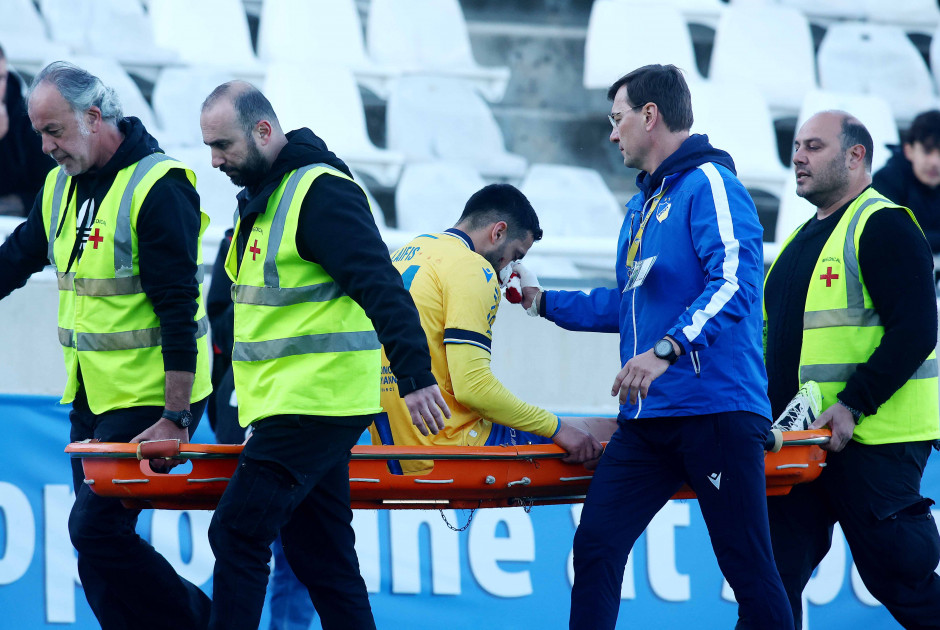 ΦΩΤΟΓΡΑΦΙΑ: Το πρόσωπο του Λαϊφη μετά το κτύπημα